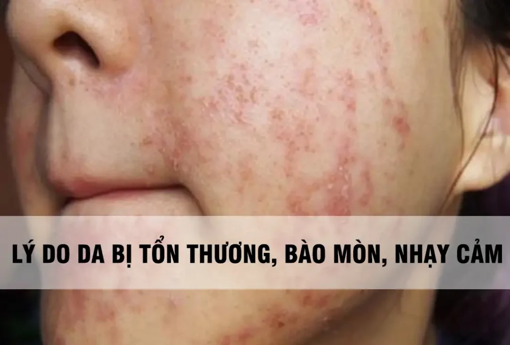 thành phần nên tránh