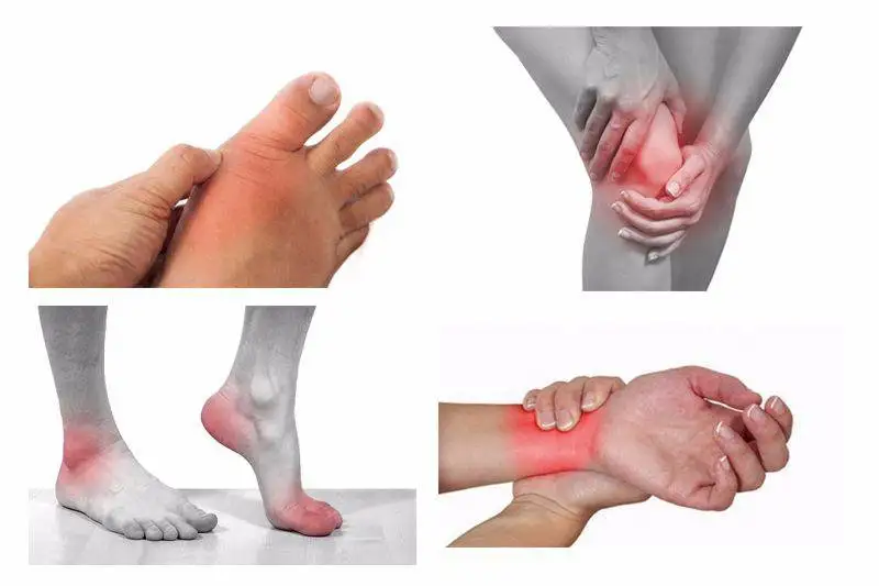 viêm xương khớp